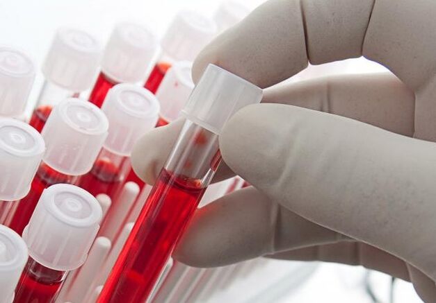 kraujo tyrimas po alkoholio vartojimo